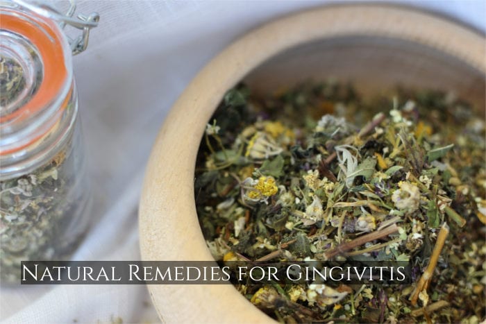 Natural Remedies for Gingivitis